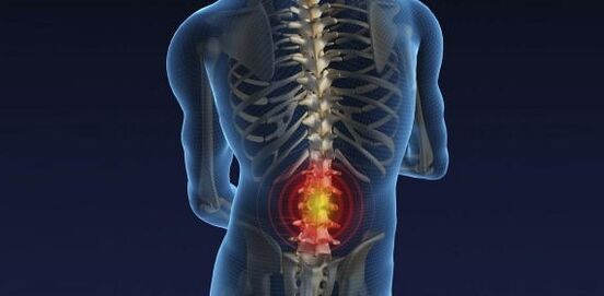roinn lumbar
