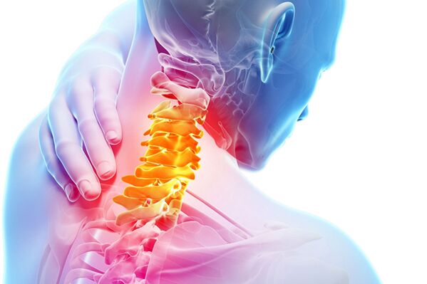 Osteochondrosis ceirbheacsach