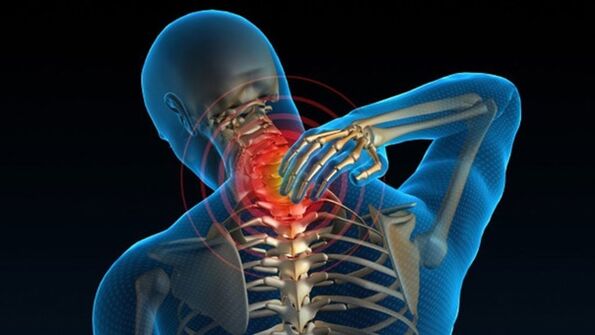 Is féidir le pian nuair a bhíonn an muineál ag casadh siondróm osteochondrosis ceirbheacsach veirteabrach le fios