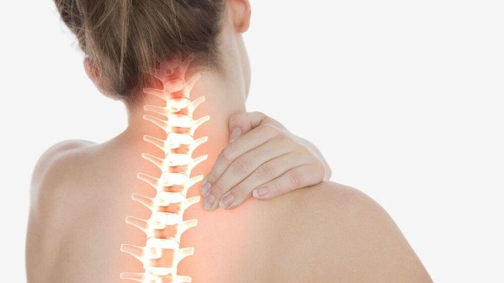 Le osteochondrosis an spine cheirbheacsach, féadfaidh siondróm radicular a fhorbairt